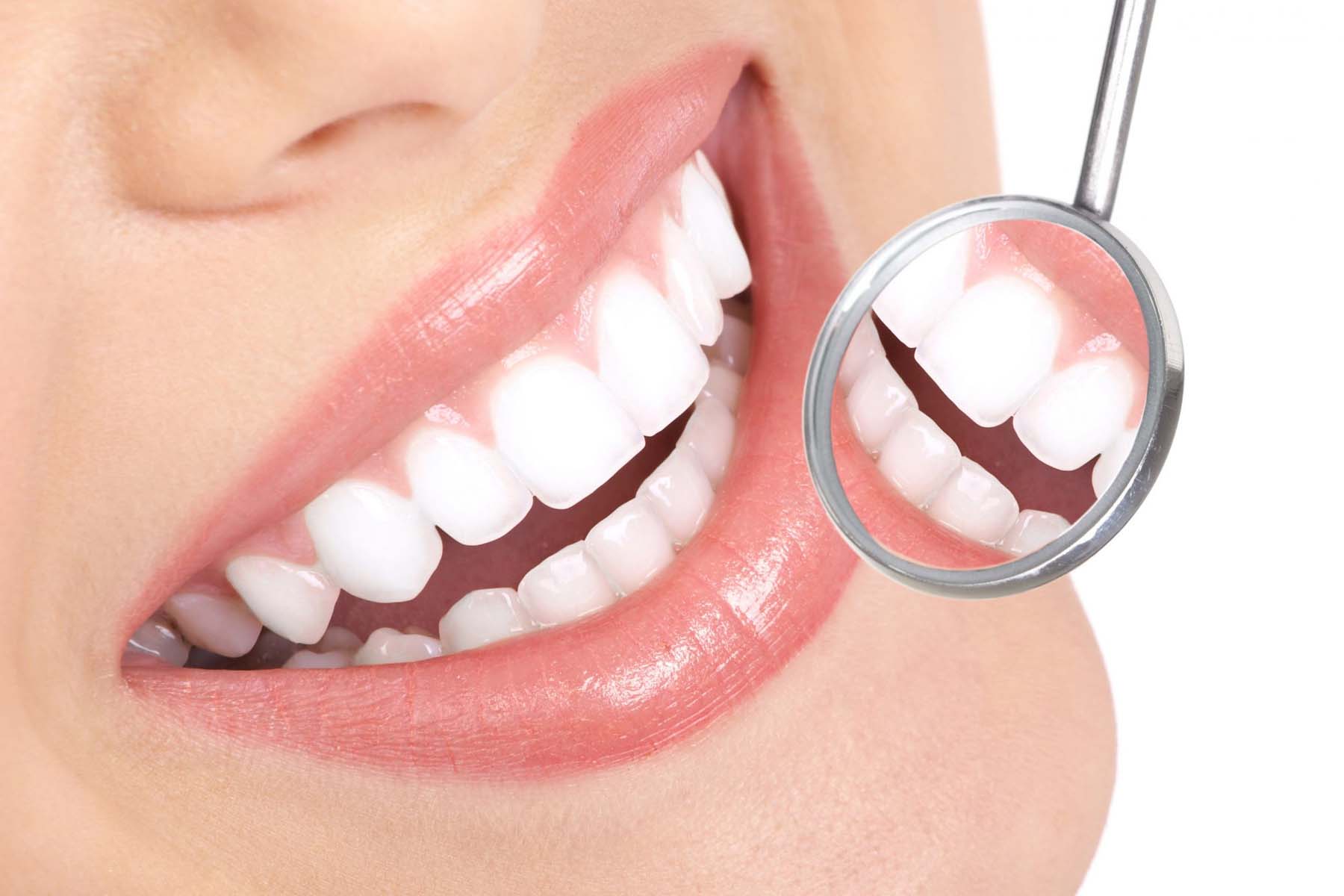 What Are 7 Common Dental Problems?